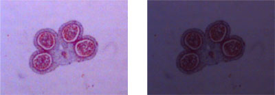 花粉粒的图像亮度好（左）和亮度较差（右）