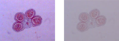 花粉粒具有良好的对比（左）和对比度差的图像（右）