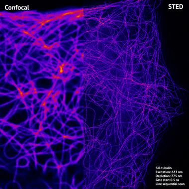 徕卡显微镜STED显微镜活细胞的光明染料