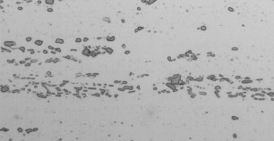 轧制铝合金组织电解抛光后用显微镜拍的照片上有很多点?
