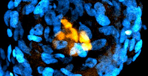 科学家利用人类干细胞构建胚胎样结构