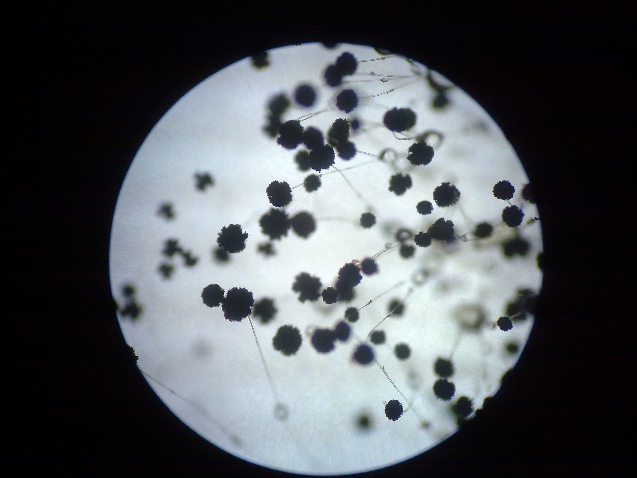 真菌黑霉的殖民地特征在培养皿的教育的 库存图片. 图片 包括有 真菌, 巴西, 传记, 概念, 食物, 霉菌 - 129825537