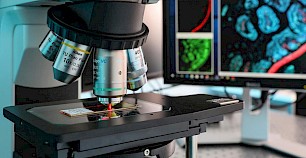 新型多视图共焦超分辨率显微镜被发布在《自然》杂志
