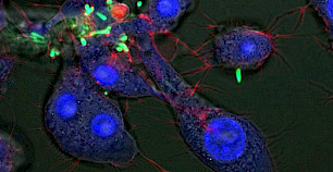 研究人员使用纳米粒子消灭隐藏在人体细胞内的危险细菌