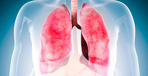 实验药物可以帮助患有哮喘、慢性阻塞性肺病、囊性纤维化和癌症相关肺病的人